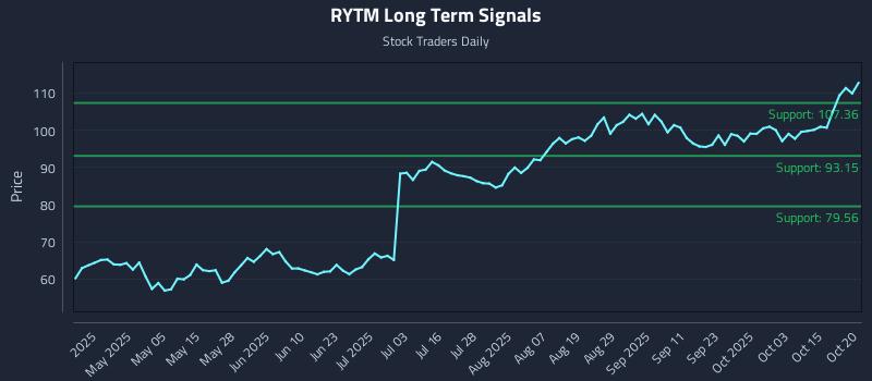 RYTM Long Term Analysis for October 20 2025 RYTM Long Term Analysis for October 20 2025