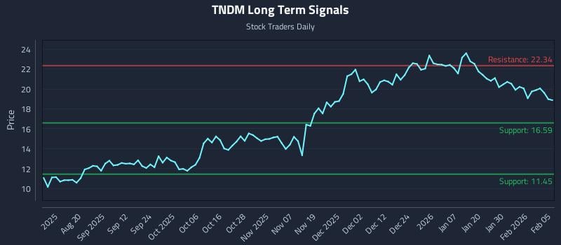 3 News Article Image Vermeidung von Verzögerungen: Echtzeit-Signale in der Bewegung von (TNDM)