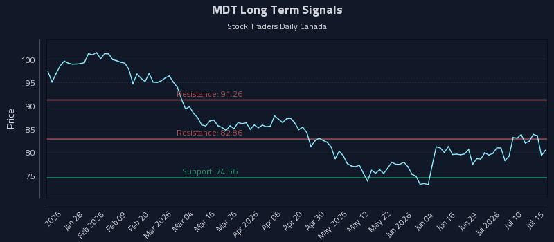 MDT